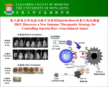 HKU discovers a new immune therapeutic strategy for controlling Epstein-Barr virus-induced tumor